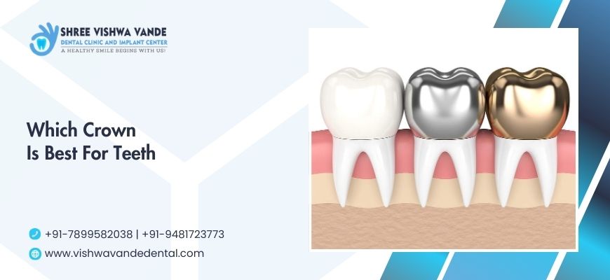 dental crowns