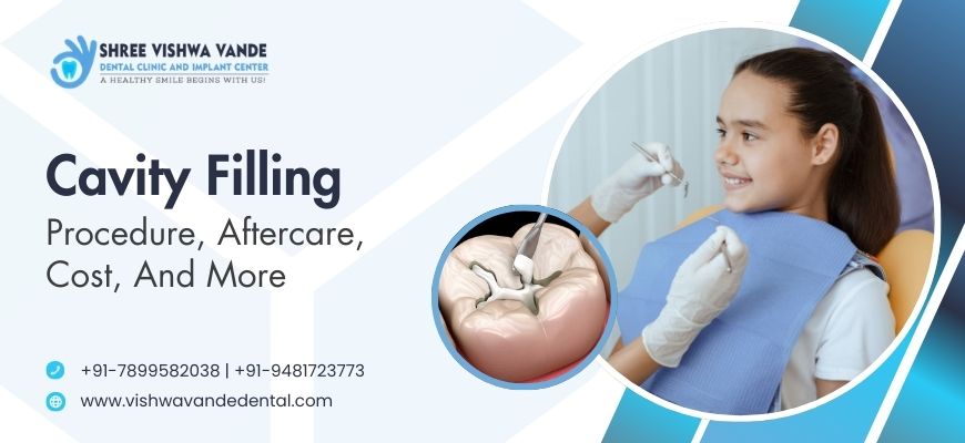 Cavity Filling: Procedure, Aftercare, Cost, and More