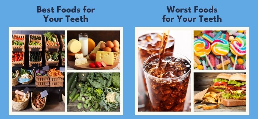 Dental Tips On The Best And Worst Foods For Oral Health
