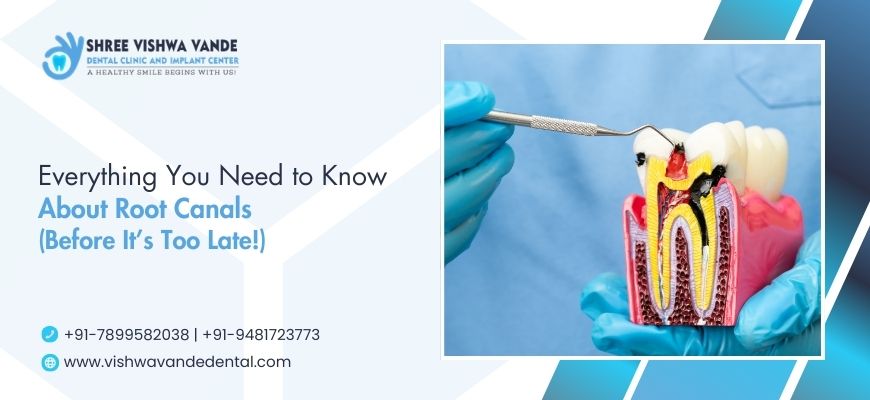 everything you need to know about root canals (before it’s too late!)