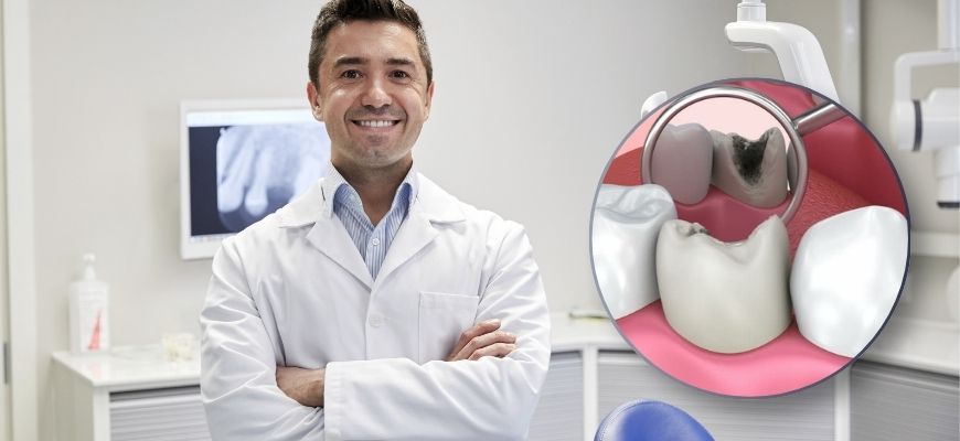 How Long Can You Leave a Cavity Untreated?