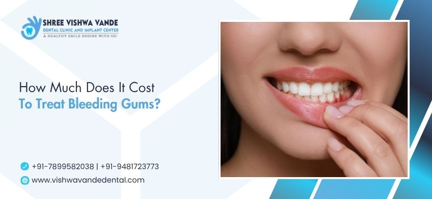 Cost To Treat Bleeding Gums