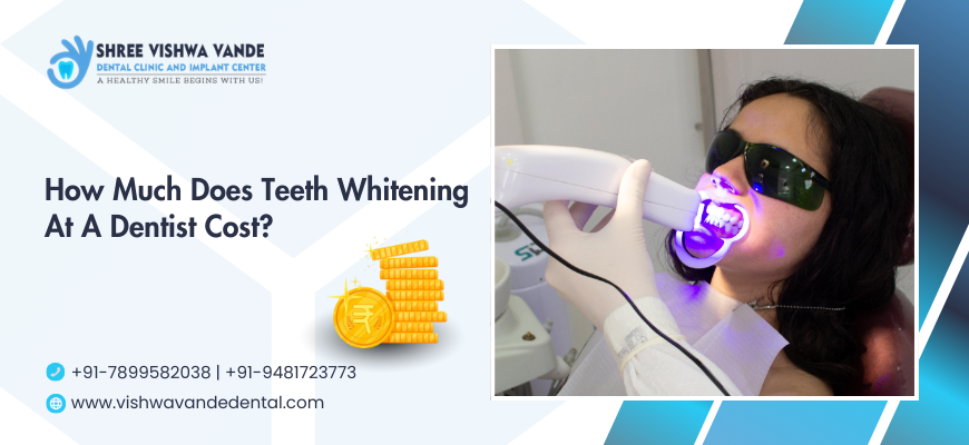How Much Does Teeth Whitening At A Dentist Cost?