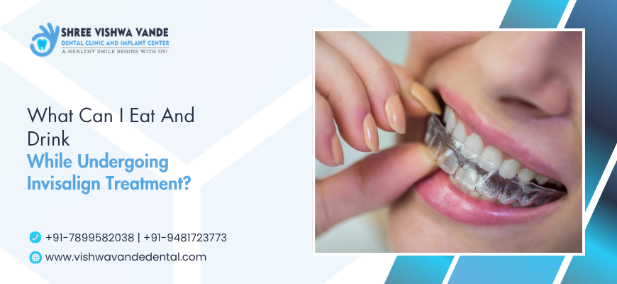 invisalign treatment